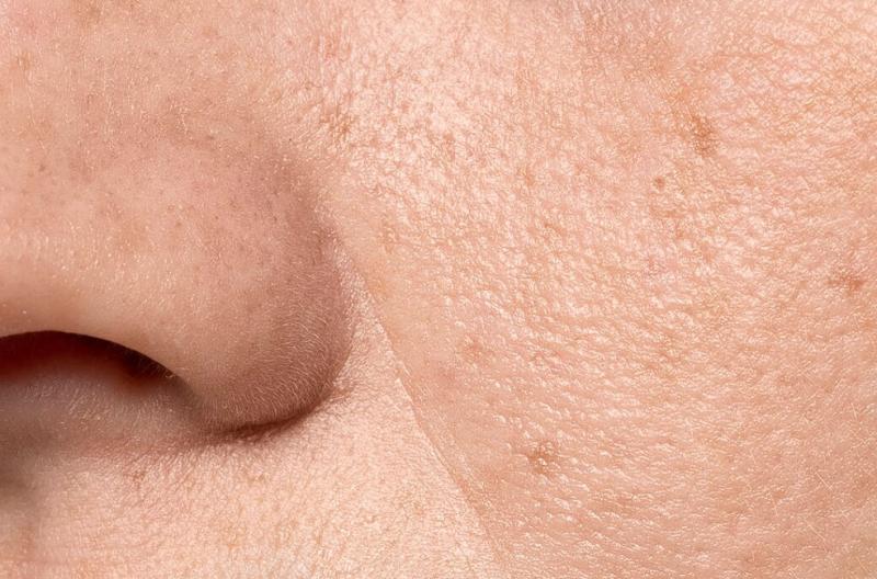 Cremas para Piel Grasa